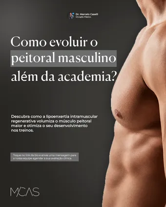 Peça de conteúdo produzida pela V2 Data Soluções para um cliente